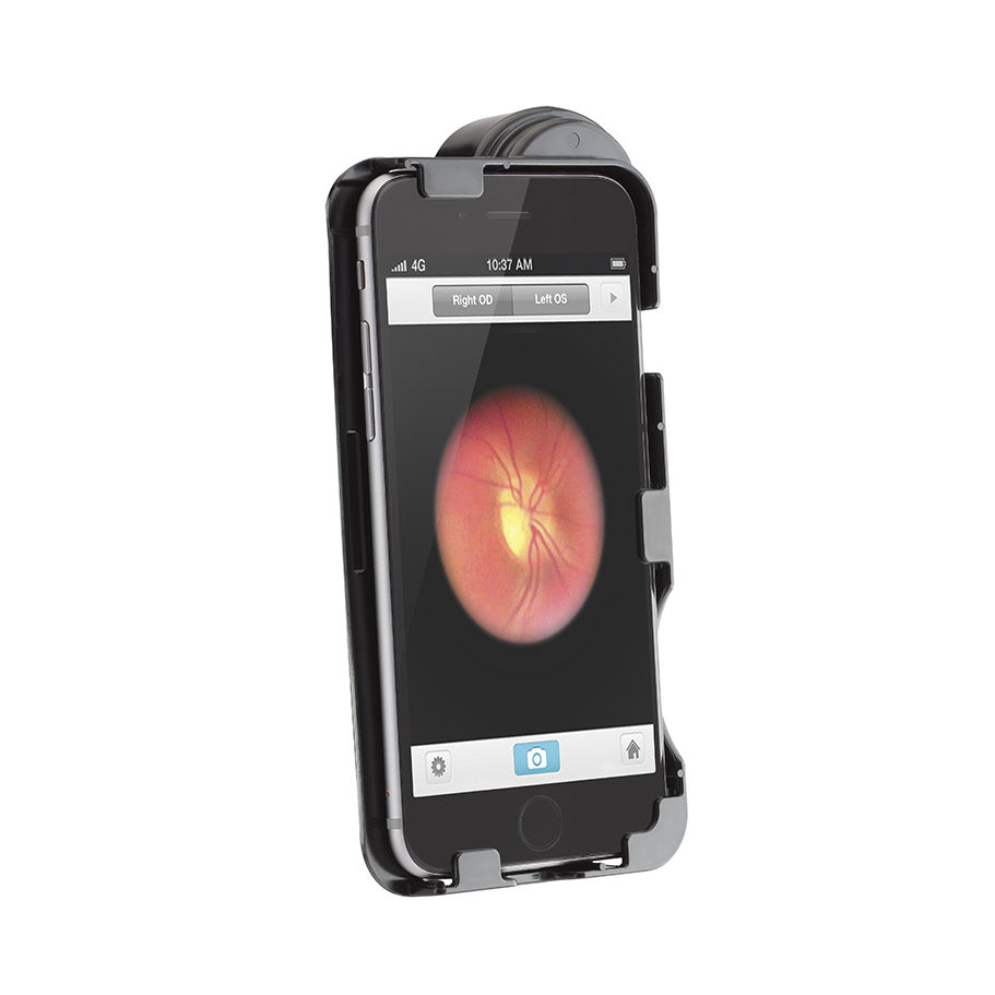 Welch Allyn iExaminer Adaptor for the iPhone 6 and 6S - CLEARANCE