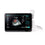 T3300 Ultrasound System
