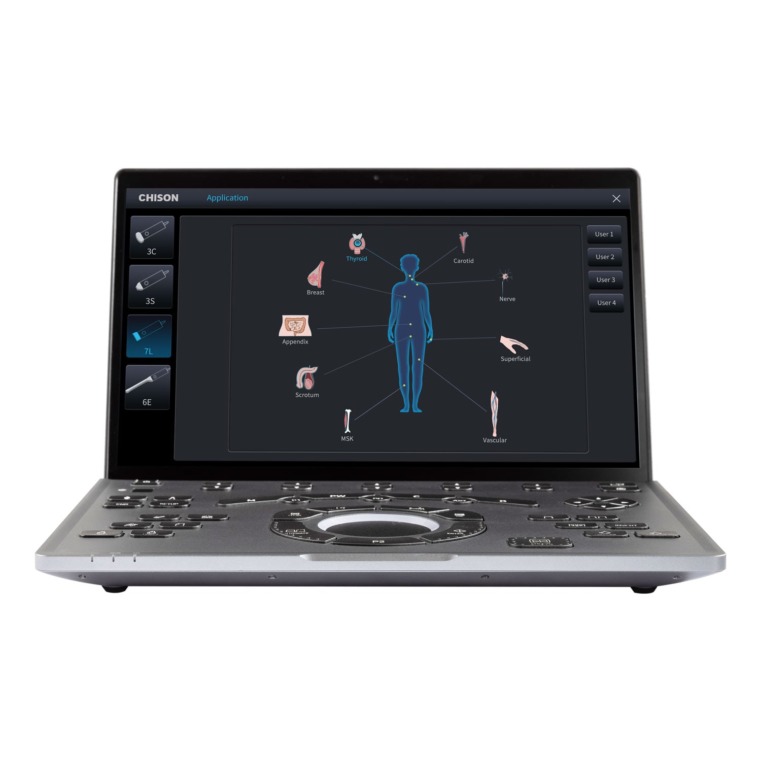 Chison SonoAir 70 Ultrasound System