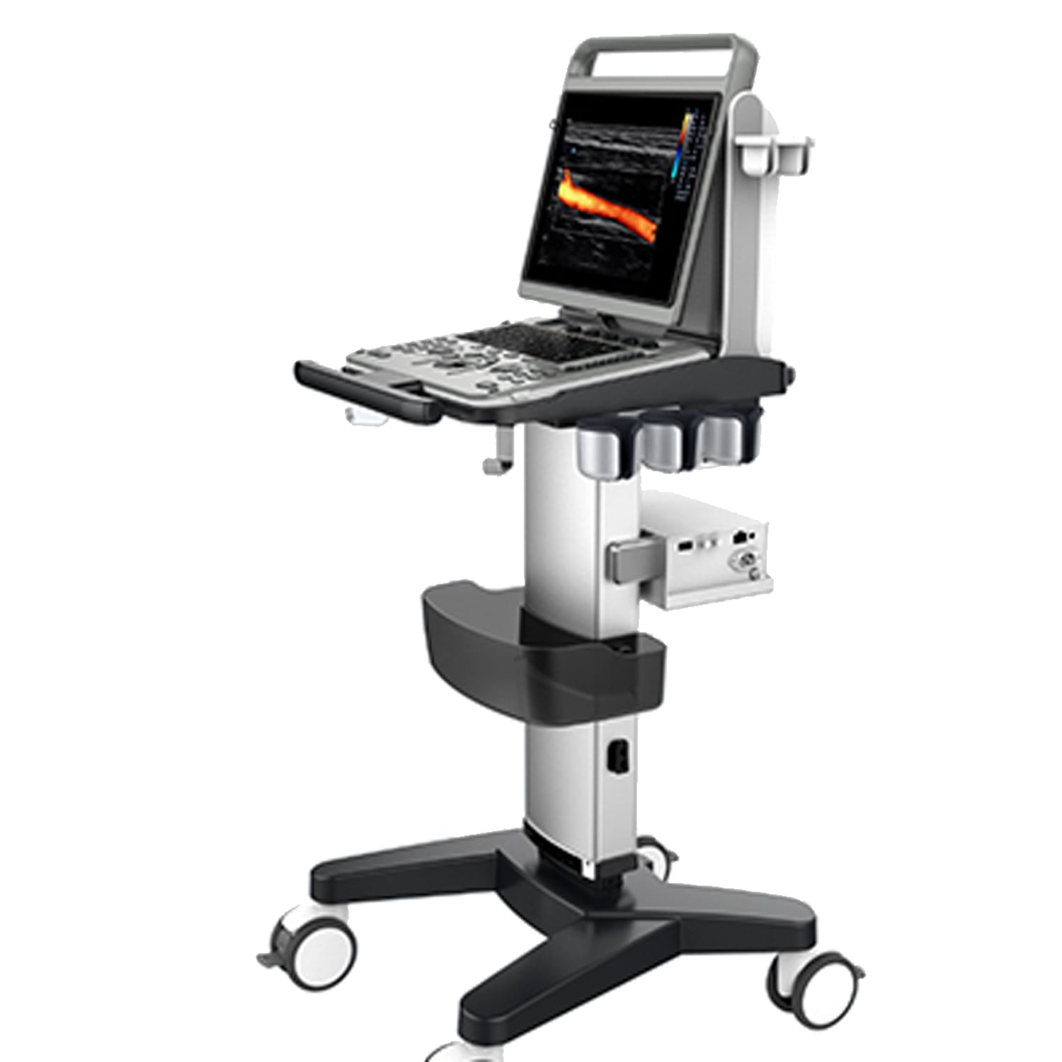 CHISON EBit 30 incl. Ultrasound Trolley