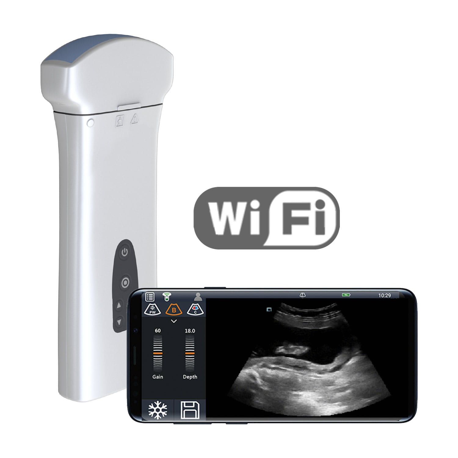 Youkey D8 mobile wireless ultrasound system