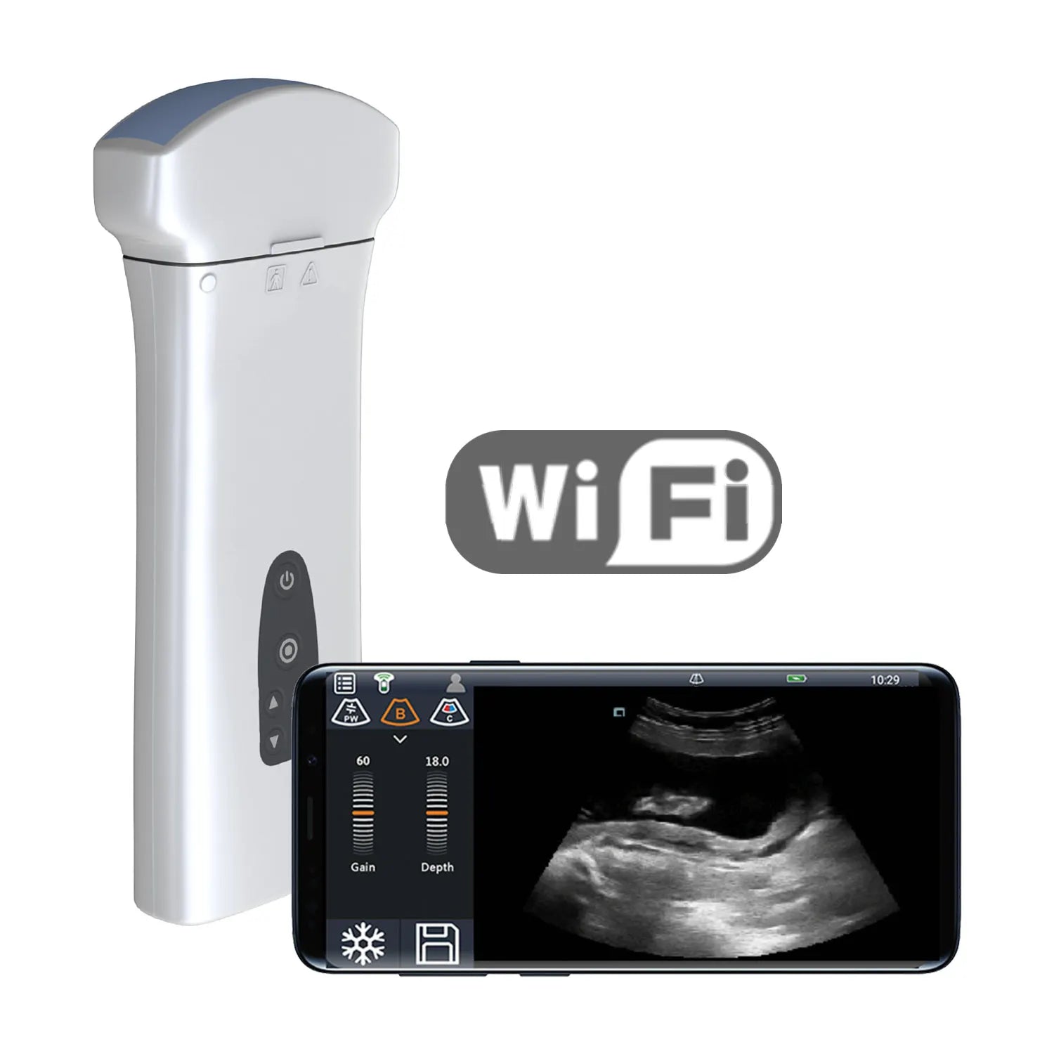 Youkey D8 Mobile Ultrasound Machine