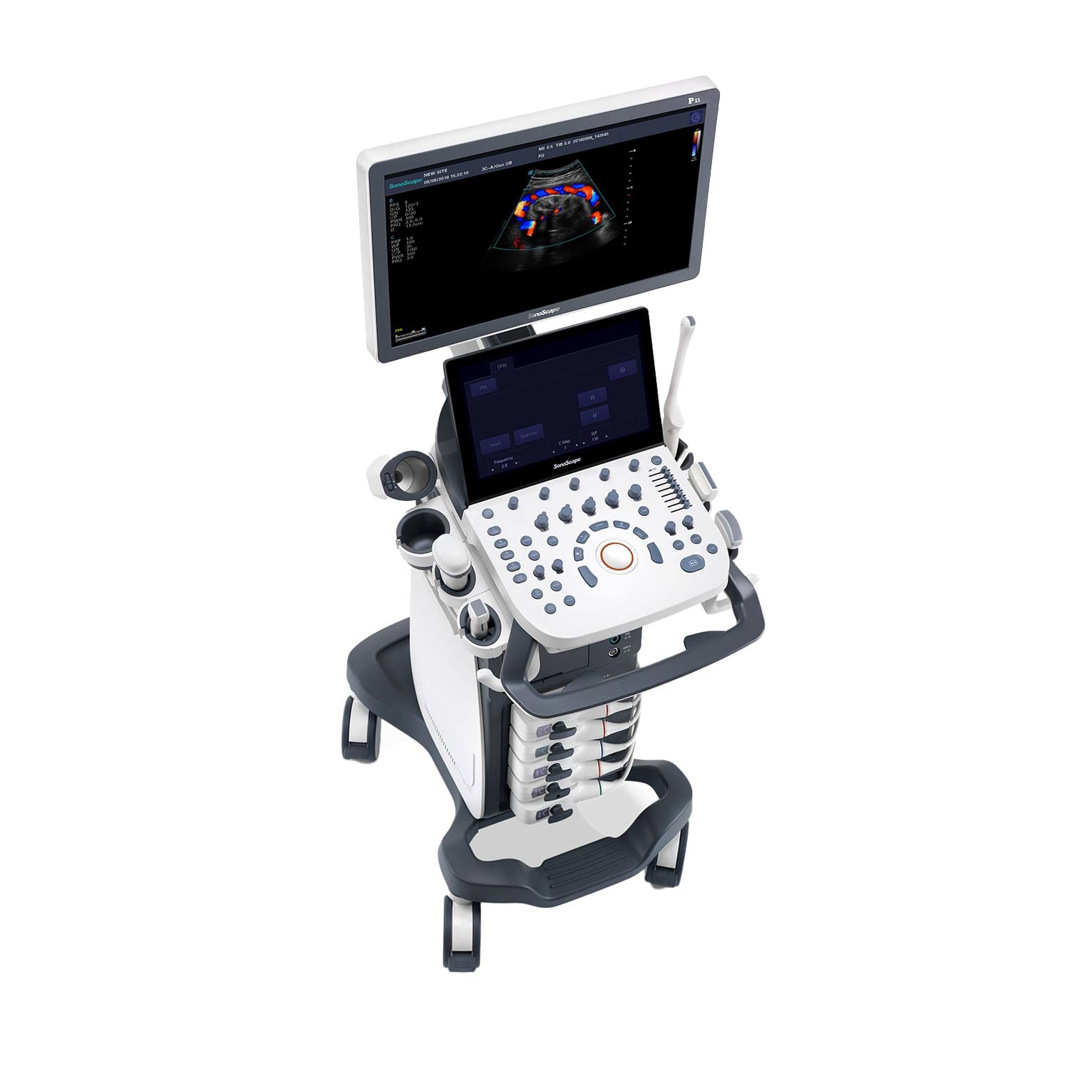 Sonoscape P15 Ultrasound Machine