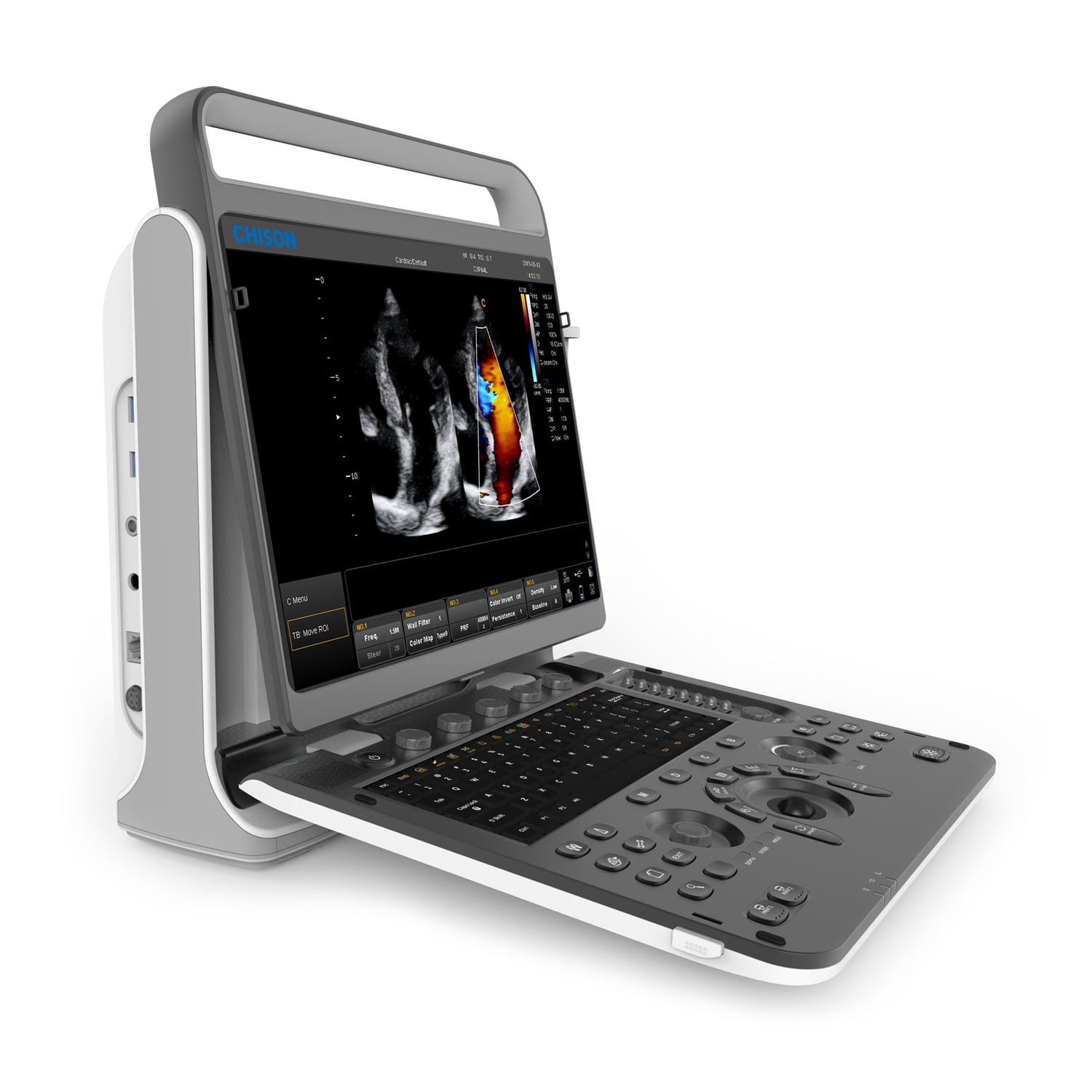 Chison EBit 60 Ultrasound System