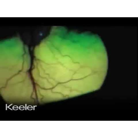 Keeler Vantage Plus Indirect LED Binocular Ophthalmoscope
