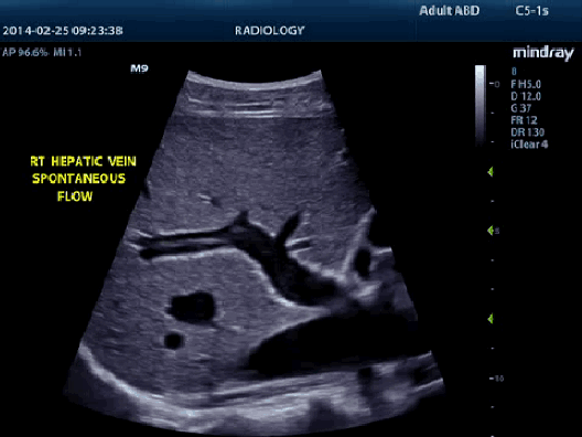 Mindray M9 Portable Ultrasound Scanner
