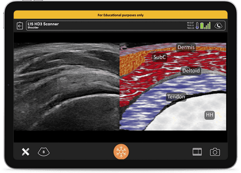 Clarius L7 HD3 wireless ultrasound scanner