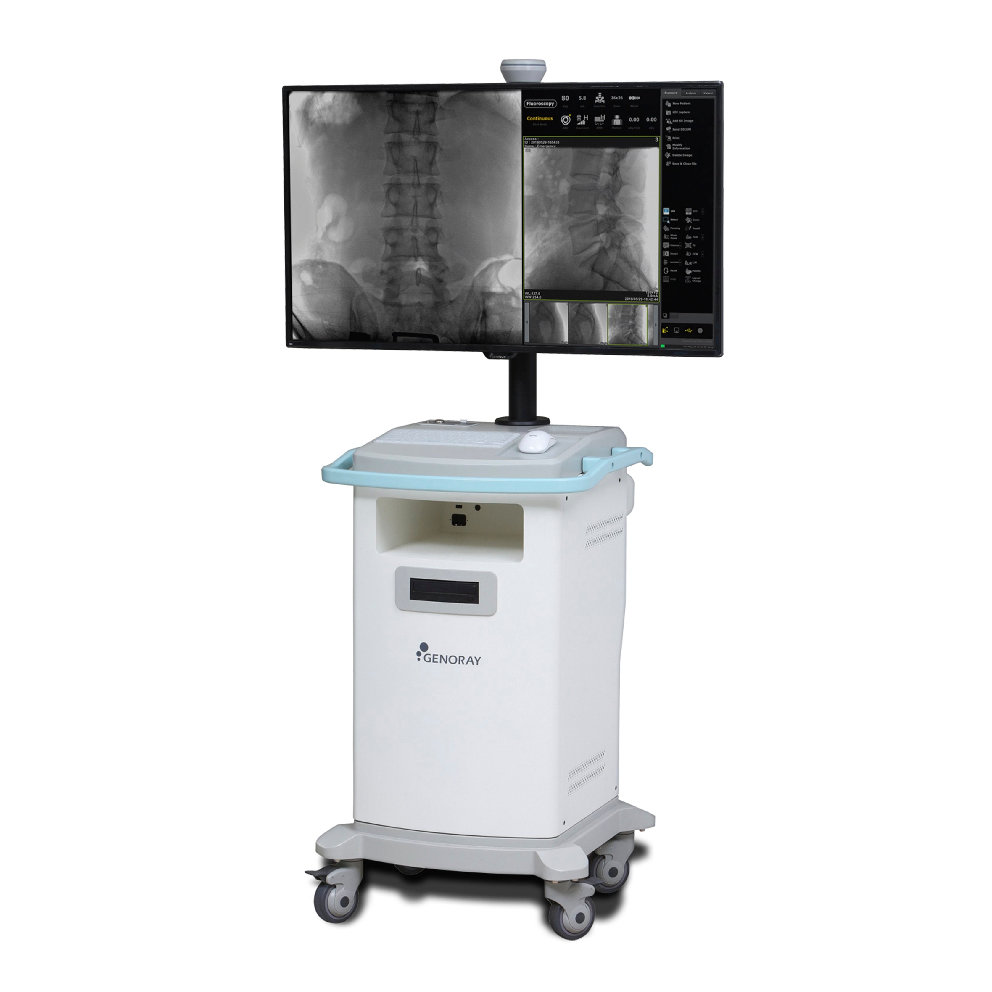 Genoray Oscar 15 C-Arm
