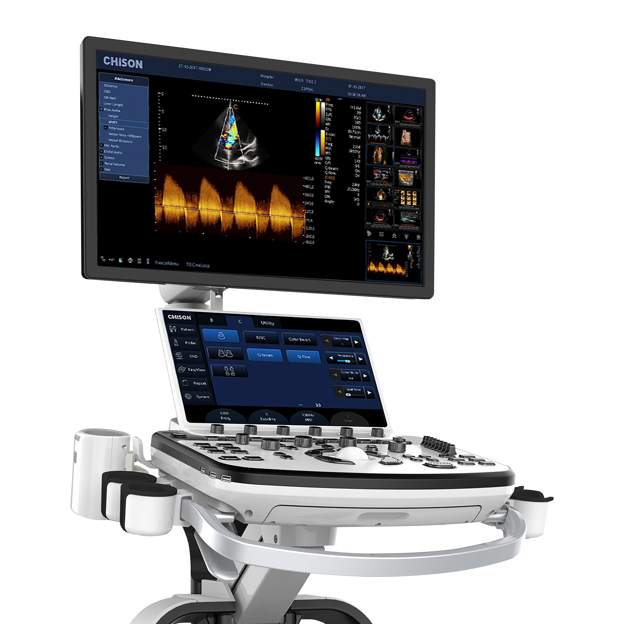 XBit 80 Color Doppler Ultrasound System