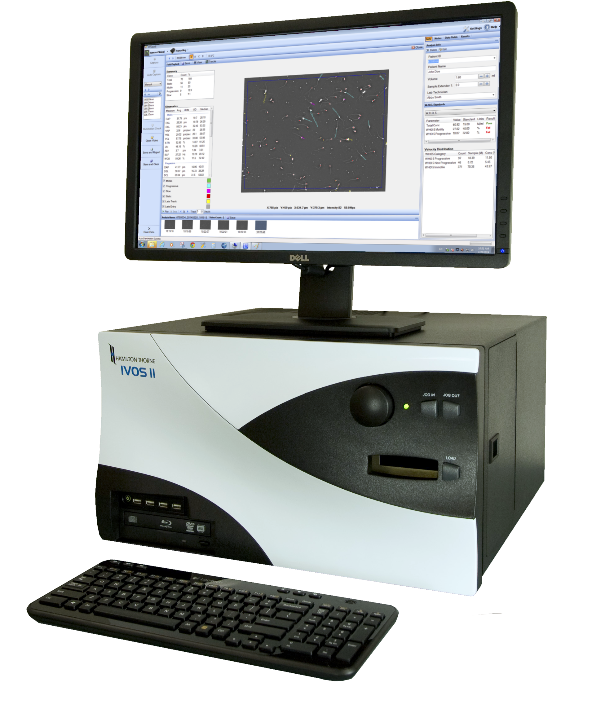 Hamilton Thorne IVOS II Sperm Analyzer
