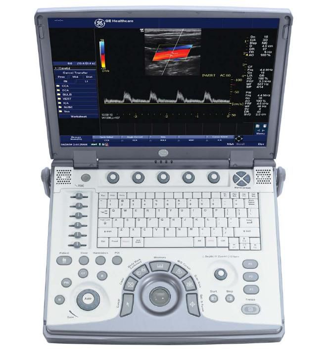 LOGIQ e Ultrasound System