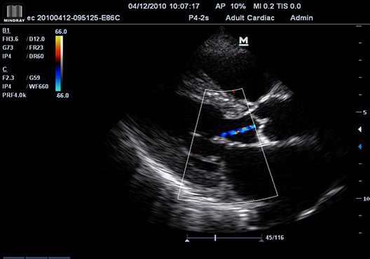 M7 portable color Doppler system o