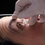 Morgan Lens - Eye Irrigation (Medi-Flow Lens)