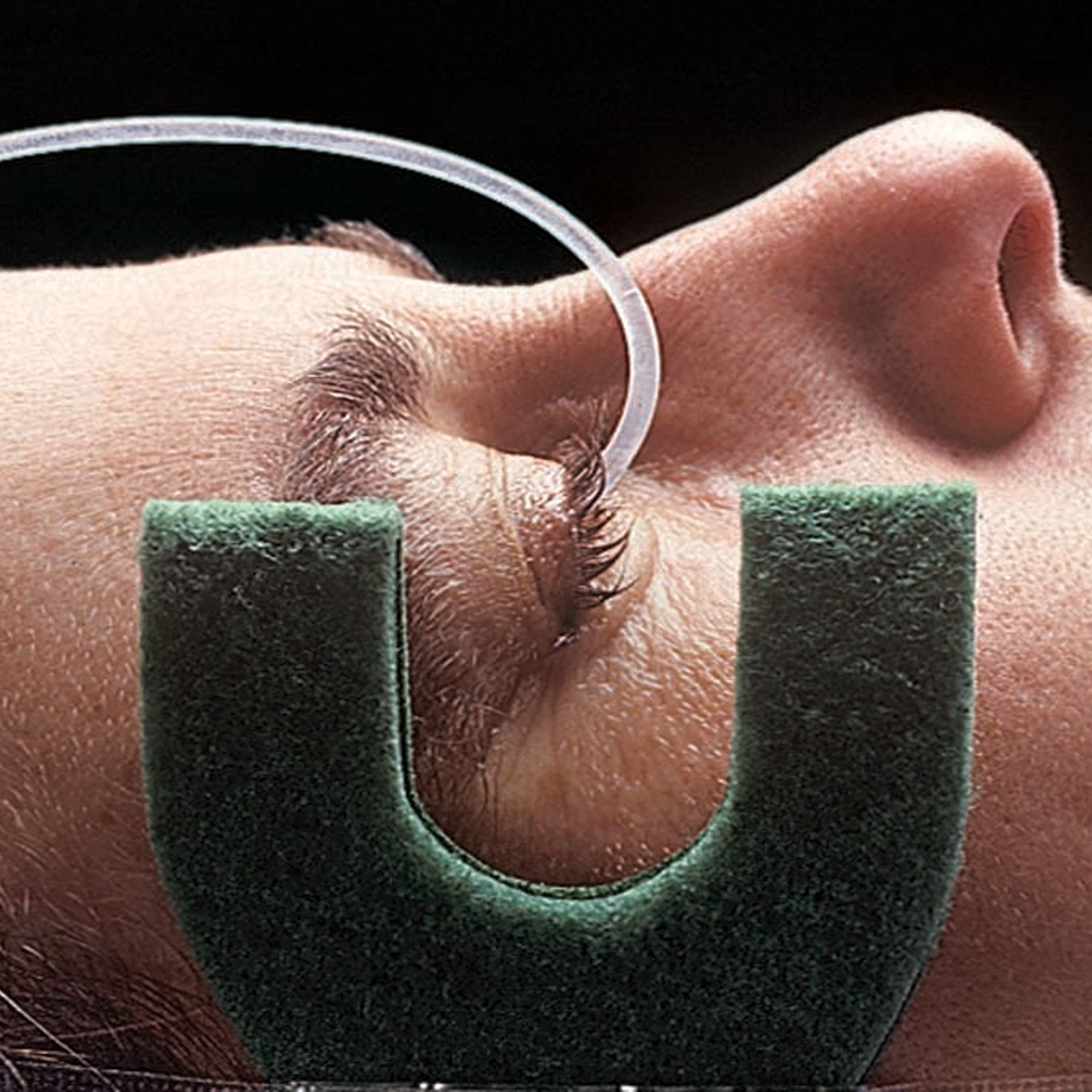 Morgan Lens - Eye Irrigation (Medi-Flow Lens)
