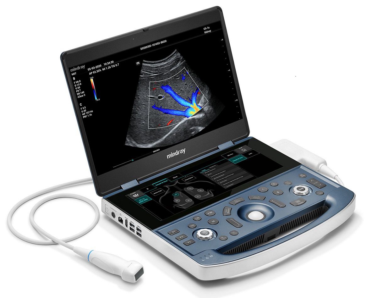 Mindray MX7 Exp Portable Ultrasound Scanner