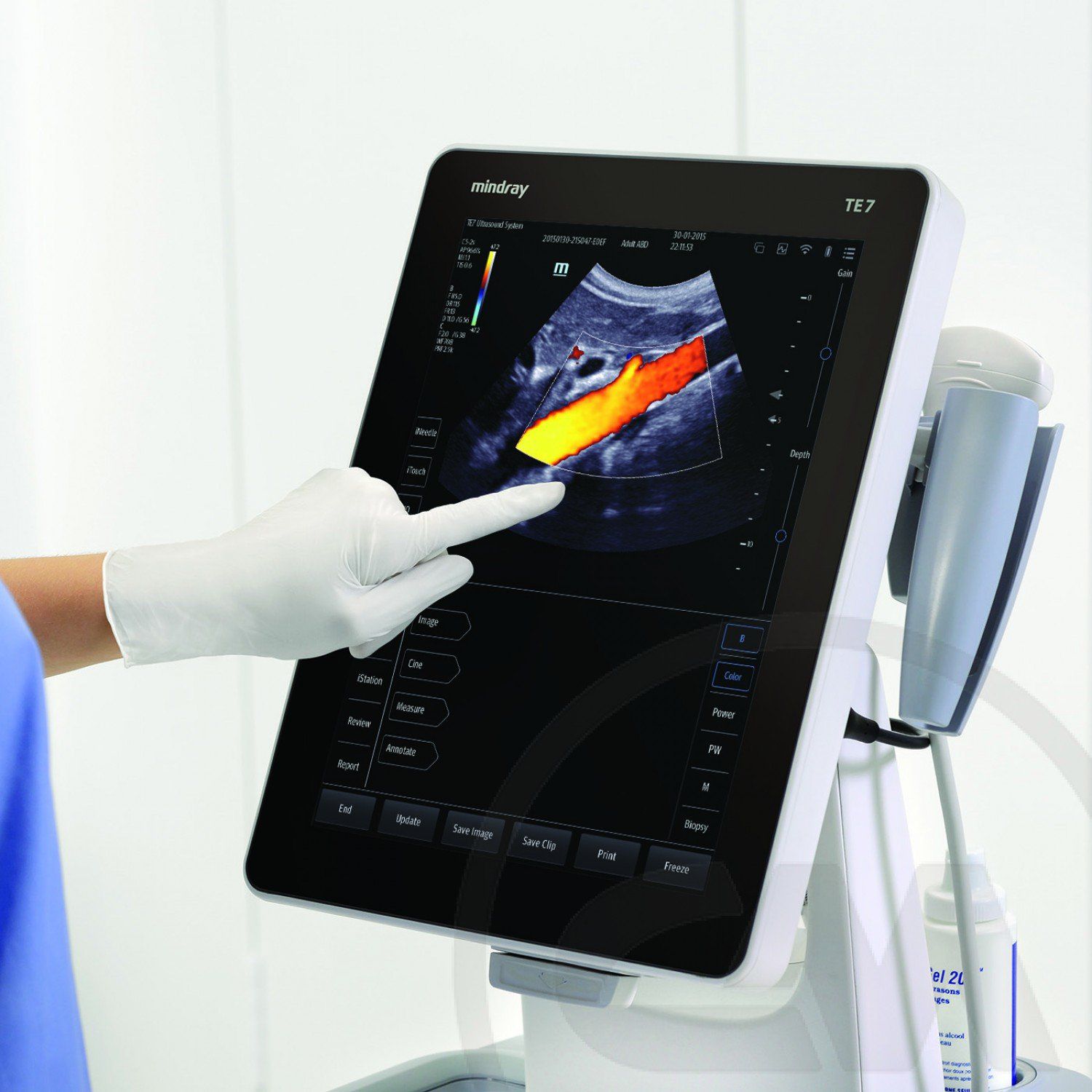 Mindray TE7 Portable Ultrasound Scanner