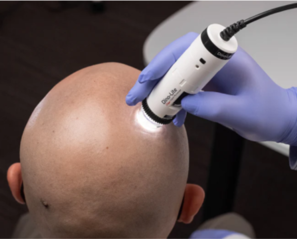 TrichoScope Polarizer Wireless
