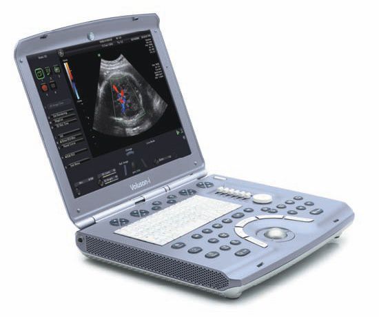 Voluson I Portable Ultrasound Scanner