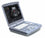 Voluson I Portable Ultrasound Scanner