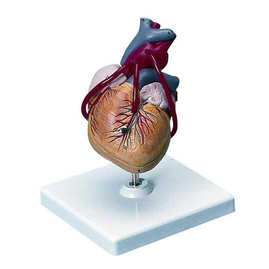 Heart Model with Bypass - CLEARANCE