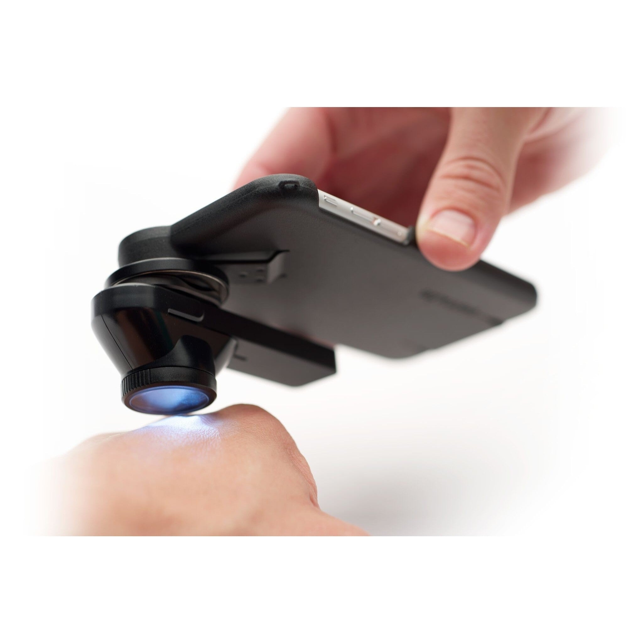 DermLite DL1 Smartphone Dermatoscope