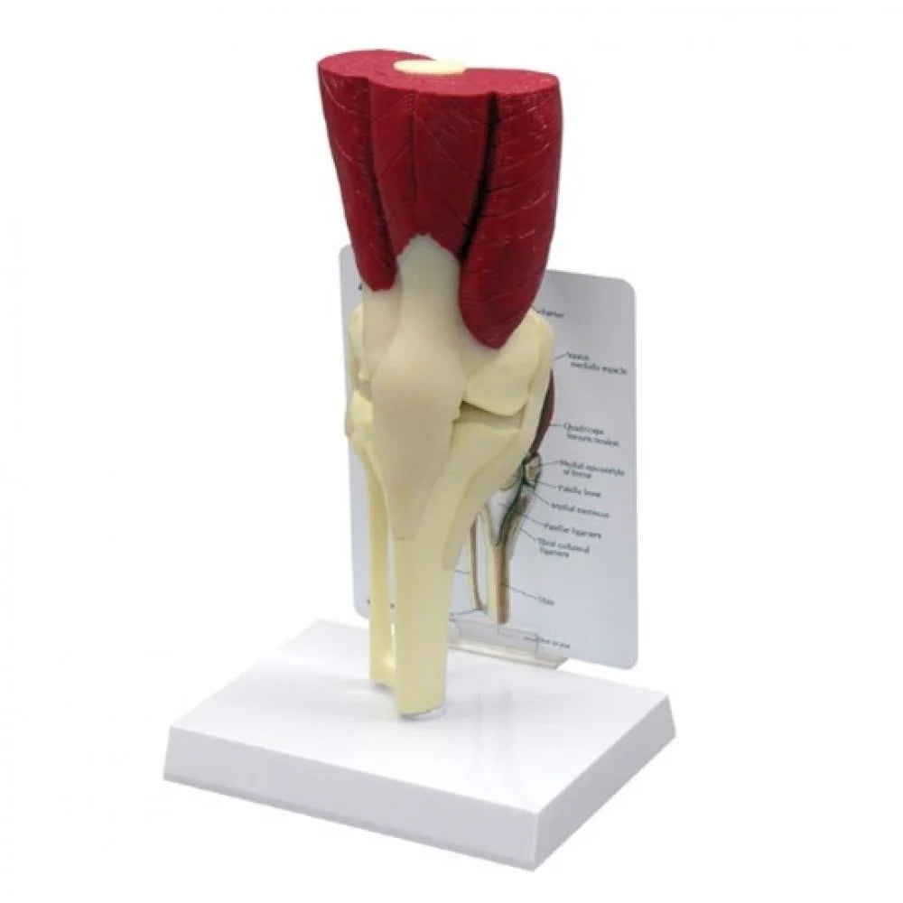 Knee Anatomy & Pathology Collection