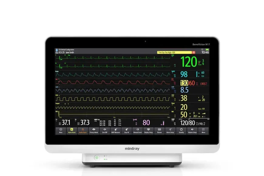 Mindray BeneVision N17 Patient Monitor