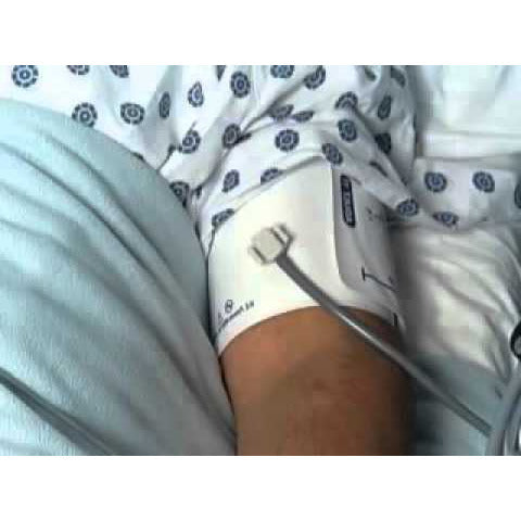 Welch Allyn Flexiport Adult Cuff size 11 One Tube Bayonet (25-34cm)